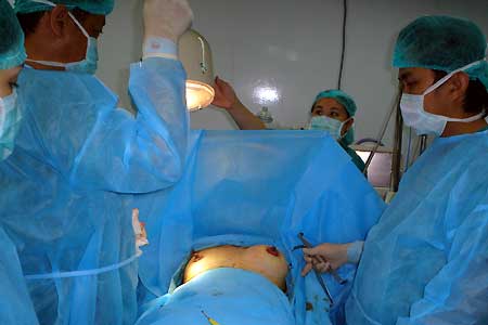 Những biến chứng khủng khiếp có thể xảy ra khi nâng ngực - Hình 1