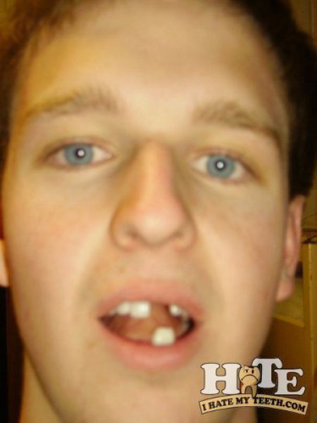 Chùm ảnh: Những hàm răng... kinh hoàng - Hình 12