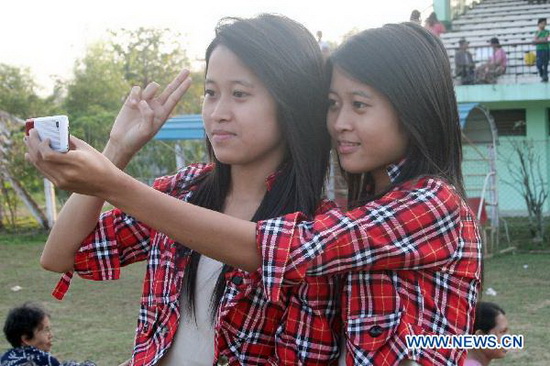 Cặp song sinh nào giống nhau nhất - Hình 7