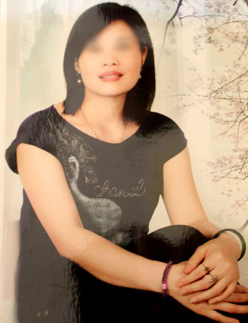 Nỗi đau người đàn bà có gương mặt biến dạng - Hình 2