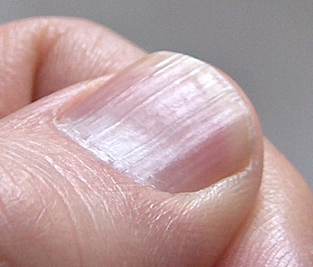 Chăm sóc móng tay để cơ thể khỏe mạnh - Hình 3