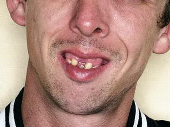 Chùm ảnh: Những hàm răng... kinh hoàng (P.2) - Hình 7
