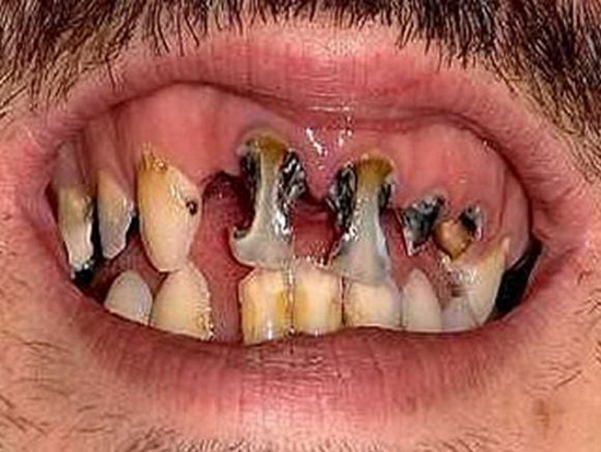 Chùm ảnh: Những hàm răng... kinh hoàng (P.2) - Hình 12