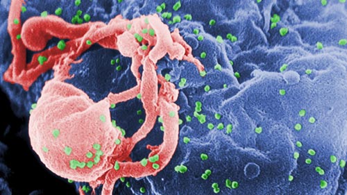 Cẩn thận với thần dược chữa HIV - Hình 1