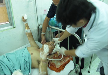 Cuồng sát vì chiếc túi 120.000 đồng? - Hình 1
