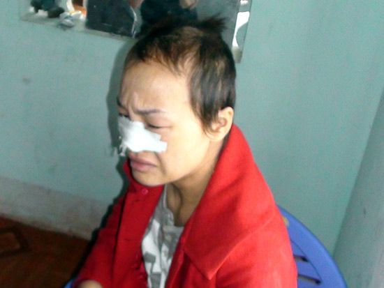Đánh ghen ở Hà Tĩnh: Chuyển công tác cán bộ VH xã - Hình 1