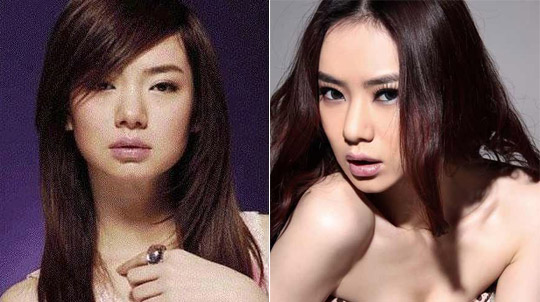 Mỹ nhân Hoa ngữ đẹp nhờ dao kéo - Hình 4