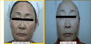 Làm đẹp da từ tế bào gốc. - Hình 5