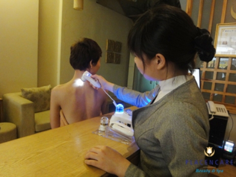 Trị mụn nhanh cho vùng lưng - Hình 1