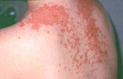 Thuốc tiêu độc có thể gây họa - Hình 2