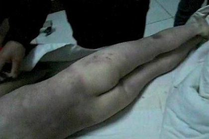 Trung Quốc: Phẫn nộ mẹ kế ngược đãi con chồng đến chết - Hình 3
