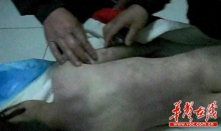 Trung Quốc: Phẫn nộ mẹ kế ngược đãi con chồng đến chết - Hình 2