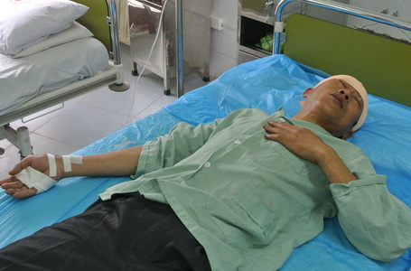 Hà Nội: Dùng búa rìu chém vỡ đầu đồng nghiệp - Hình 1