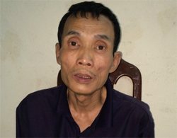 Giăng bẫy các cặp tình nhân trong công viên - Hình 1