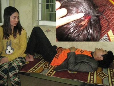 Bức xúc, giám đốc chi nhánh tẩn sếp nhập viện - Hình 2