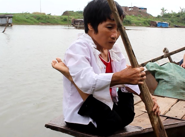 Cuộc sống của người phụ nữ có đôi chân hình chữ V - Hình 1