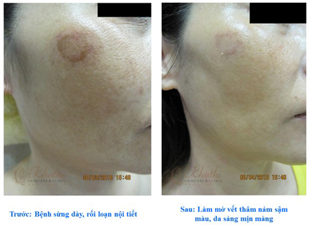 Bảo vệ nhan sắc trước thử thách của thời gian - Hình 4