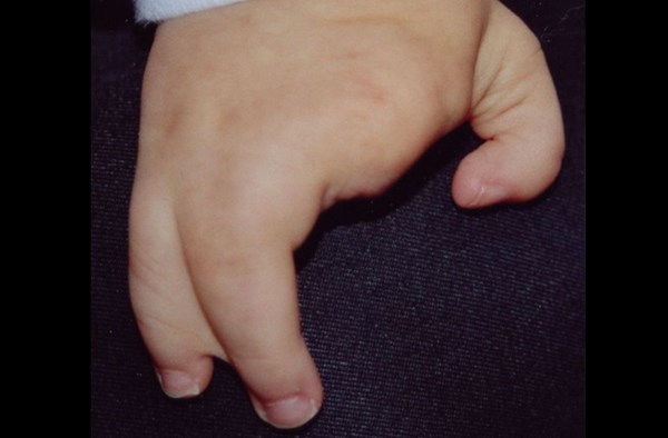 10 căn bệnh quái dị và đáng sợ nhất trên thế giới - Hình 5
