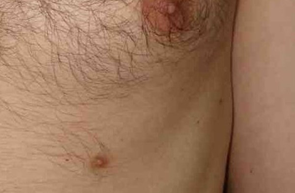 10 căn bệnh quái dị và đáng sợ nhất trên thế giới - Hình 7