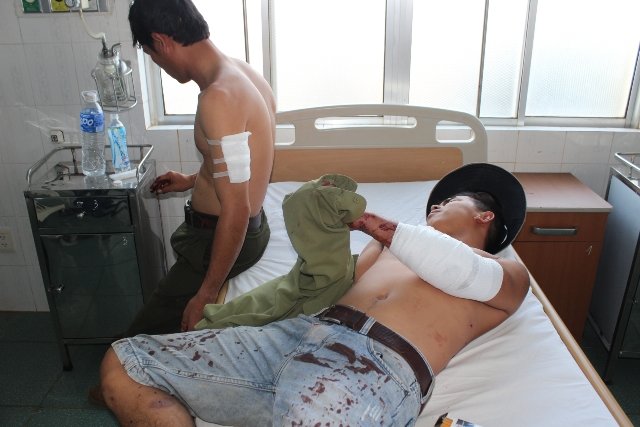 Bắt đối tượng dùng dao chém kiểm lâm trọng thương - Hình 2