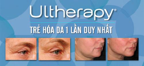 Khuyến mại cực sốc dịch vụ trẻ hóa da, nâng cơ Ultherapy - Hình 5