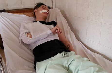 Sao Việt liên tiếp bầm dập vì nạn cướp giật - Hình 2