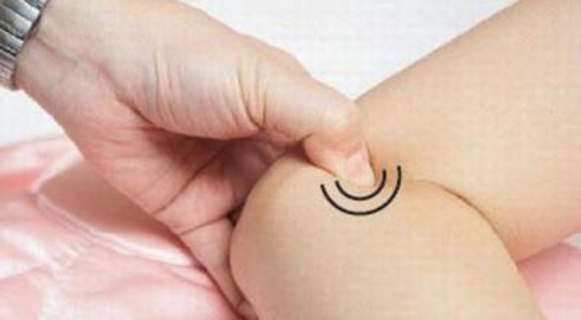 Tay chân lạnh: Cách bấm huyệt trị bệnh - Hình 1