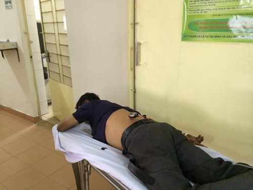 Ngăn cản trộm chó ở Sài Gòn, một người bị bắn ngất xỉu - Hình 1