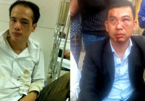 Phản ứng của luật sư bị đánh về kết quả điều tra của công an - Hình 1