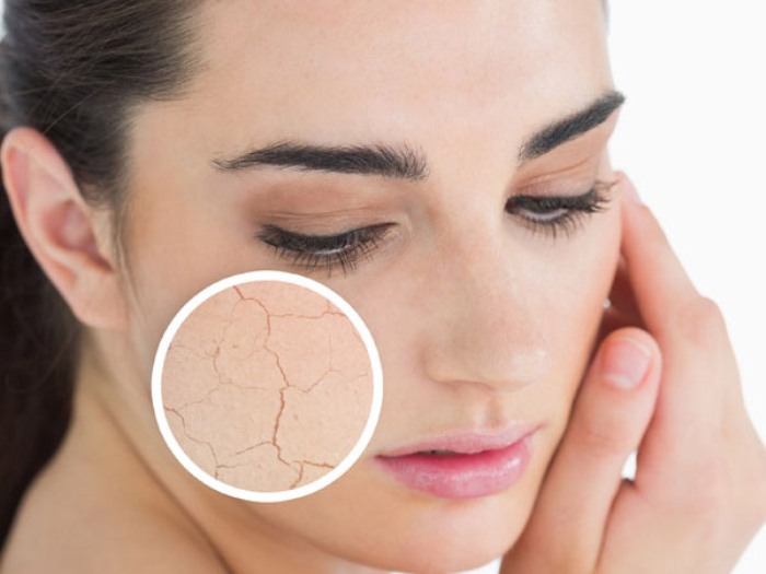 Bí quyết để không bị nẻ trong mùa đông - Hình 1