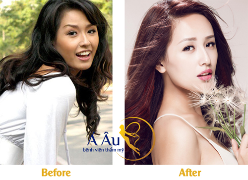 Làn da căng mịn sau Tết nhờ collagen tươi - Hình 3