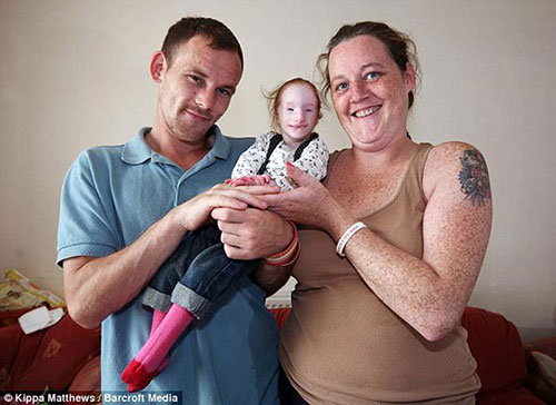 Meet The Smallest Girl In The World