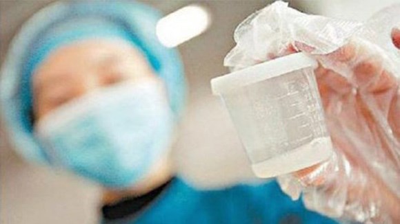 Nở rộ trào lưu làm đẹp bằng tinh dịch đàn ông - Hình 1