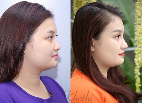 15 phút tạo sóng mũi cao như sao Hàn - Hình 3