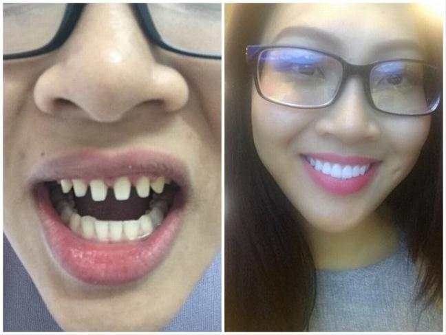 Hoa khôi Diệu Ngọc lên tiếng bóc sự thật về nghi án dao kéo, gian xảo với bạn cùng thi - Hình 2