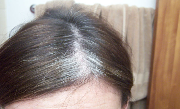 7 lợi ích của Vitamin E với tóc không phải ai cũng biết - Hình 3