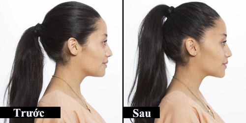 Thay đổi kiểu tóc sẽ giúp mặt thon gọn trong nháy mắt - Hình 10