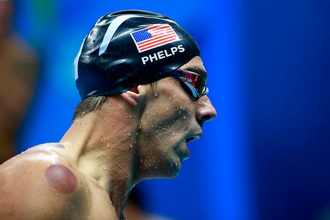Khi VĐV kéo nhau đi giác hơi tại Olympic - Hình 4