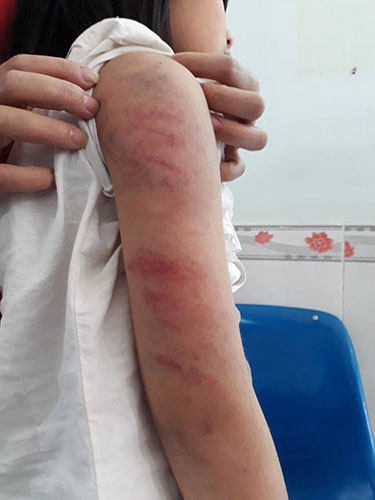 Khởi tố ông bố đánh con gái bầm tím người vì... 10 nghìn đồng - Hình 2