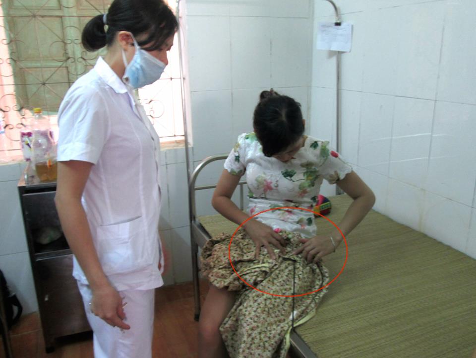 Đối tượng nghi ngáo đá dùng nỏ bắn 3 người đi đường trọng thương - Hình 1