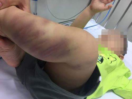 Bé 1 tuổi bị bạo hành: Trẻ được bảo vệ kiểu cha chung không ai khóc - Hình 1