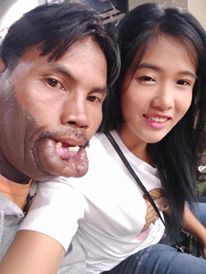 Xấu đau đớn vẫn cưới được vợ đẹp như hot girl, đẻ con ra 'người quỷ' khóc òa vì choáng - Hình 2