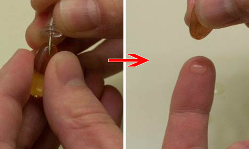 Lấp đầy vết sẹo rỗ chỉ bằng rau má và vitamin E giá chưa đến 20 nghìn! - Hình 8