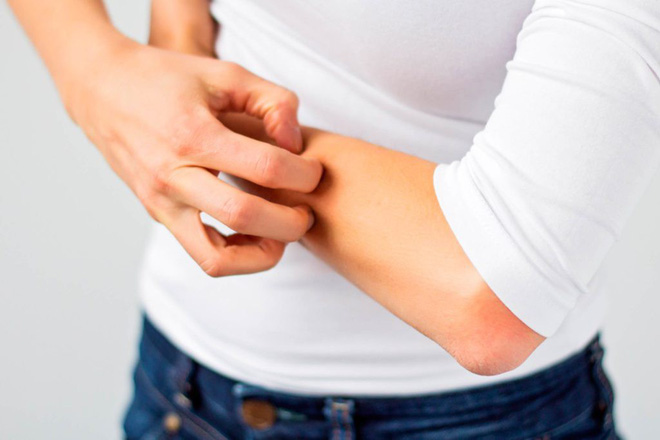 Thận của bạn có thể đang âm thầm kêu cứu với các triệu chứng này - Hình 1