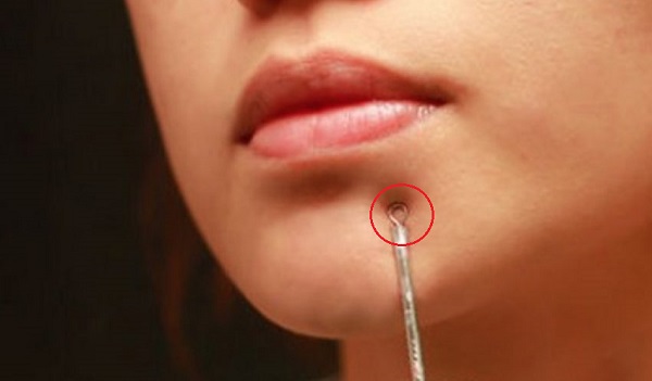 5 mẹo đánh bay mụn đầu đen xung quanh môi nhanh và hiệu quả - Hình 5