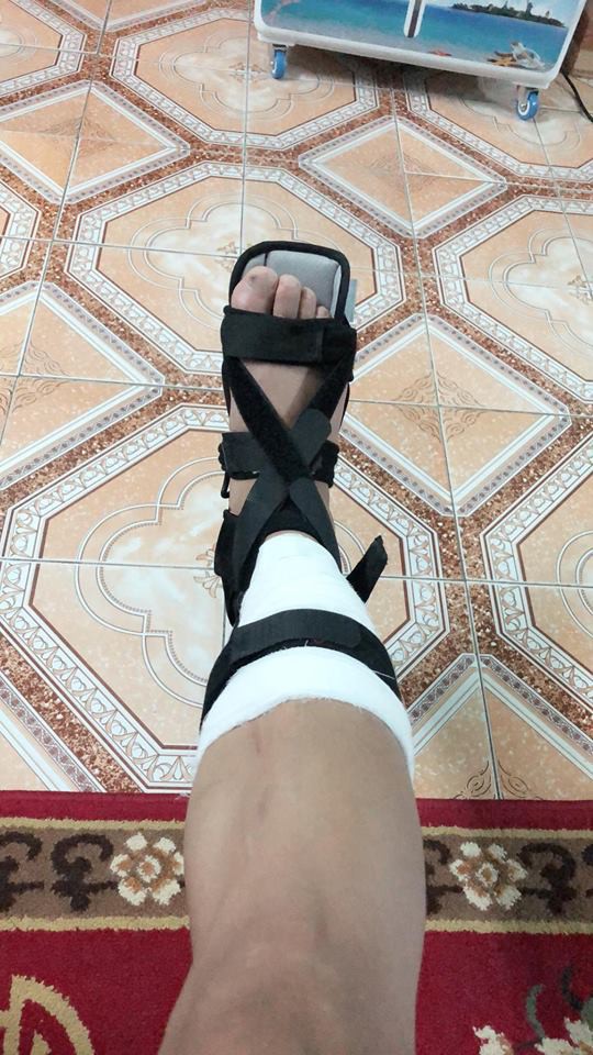 Chết cười với phản ứng của Đức Huy khi thấy Xuân Mạnh đăng ảnh bị chấn thương ở chân - Hình 1