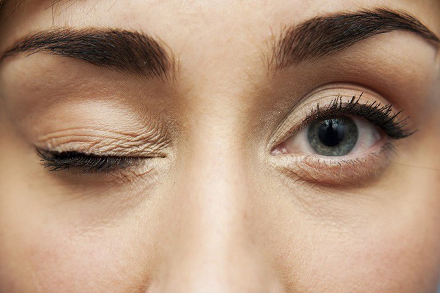 9 dấu hiệu bất thường trên đôi mắt cảnh báo bệnh tật nguy hiểm - Hình 5