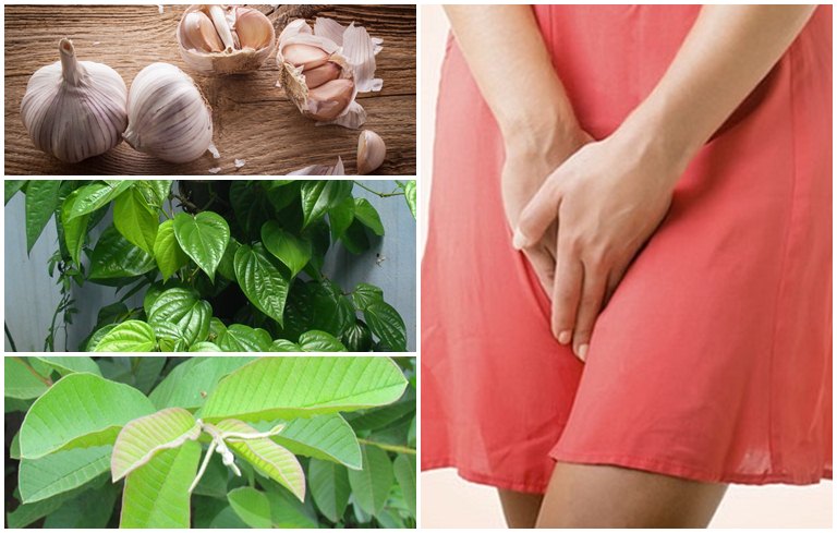 3 cách chữa bệnh nấm âm đạo phổ biến nhất hiện nay - Hình 1