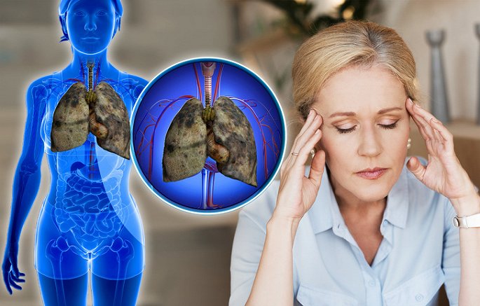 5 dấu hiệu của bệnh ung thư phổi nhiều người thường bỏ qua - Hình 5