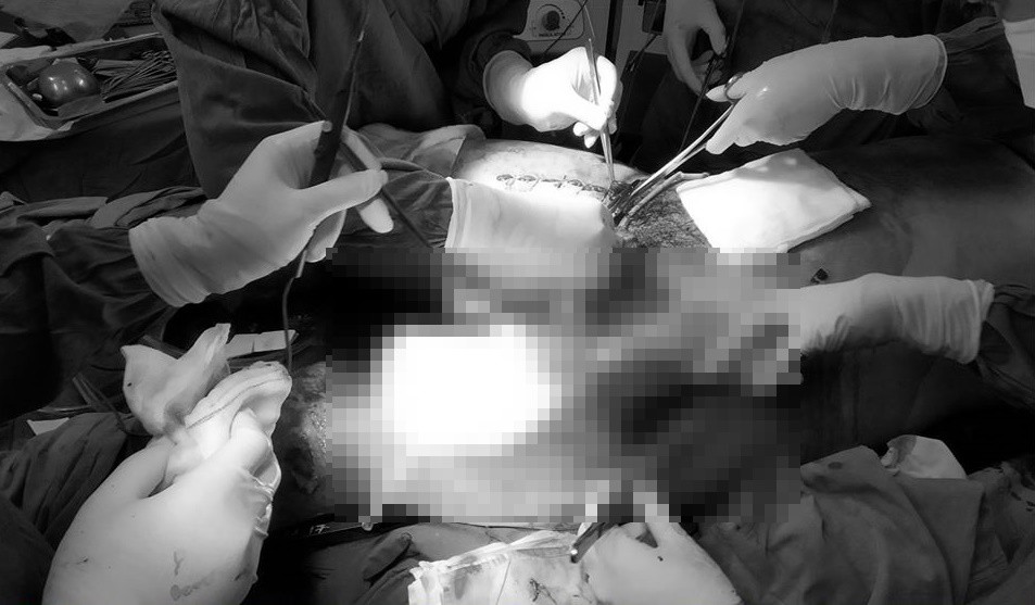 Cứu sống bệnh nhân bị tai nạn giao thông nguy kịch tính mạng nhờ báo động đỏ - Hình 2